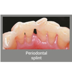 Angelus Interlig - Braided Glass Fiber impregnated with light-cured composite resin