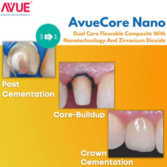 AVUE AvueCore Nano - Dual Cure Flowable Core Buildup composite with Nano Zirconium Dioxide