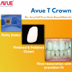 AVUE AvueT Crown - Flurorescent Temporary Crown  & Bridge Material