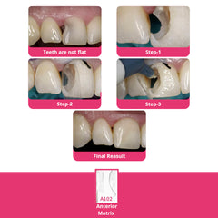 Bioclear Anterior Matrix - Clear Anatomical Sectional Matrices