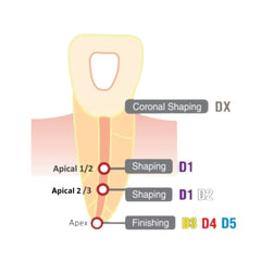 DiaDent Dia-X Files - Heat Treated Ni-Ti Rotary File System