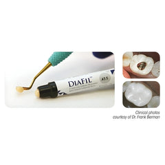 DiaFil™ – Light-Cured Nanohybrid Universal Composite