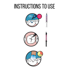 SDI Conseal F - Fluoride Releasing Pit & Fissure Sealant