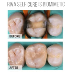 SDI Riva Self Cure - Bulk Fill Glass Hybrid Restorative Cement