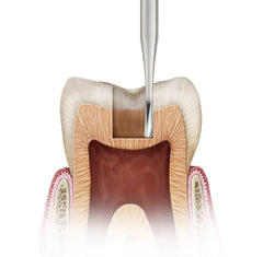 SS White Carbide Bur - Amalgam Preparation burs