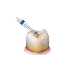 Avue True Diamond Burs- BC Series- Ball Collar Shaped