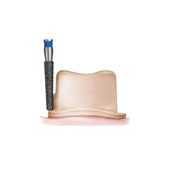 Avue True Diamond Burs- RS Series- Rounded Shoulder Burs