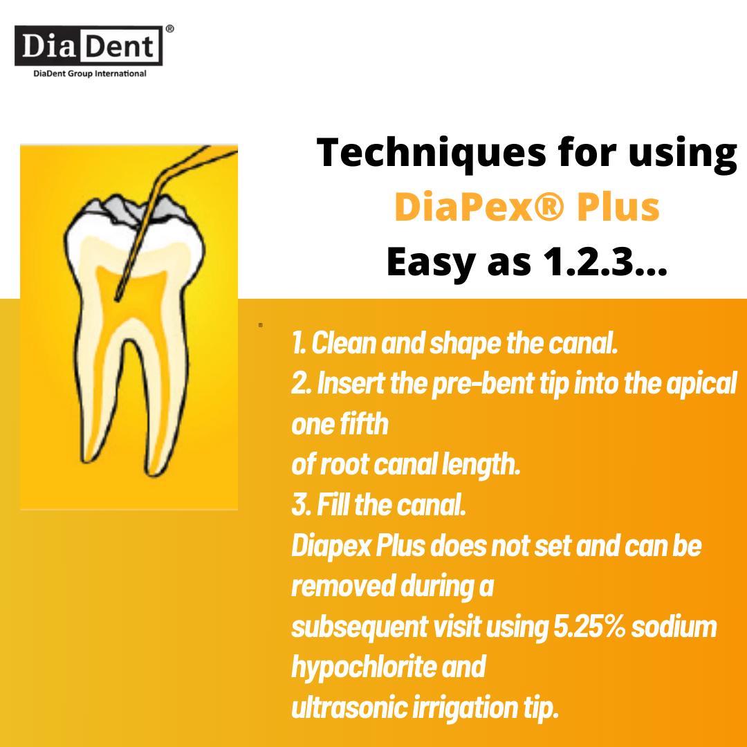DiaDent DiaPex Plus Feature Details