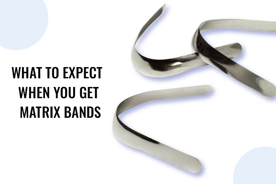 Matrix Band Numbers What to Expect When You Get Matrix Bands – Dental Avenue