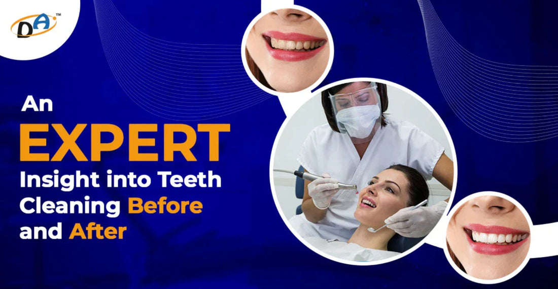 An Expert Insight into Teeth Cleaning Before and After