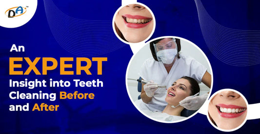 An Expert Insight into Teeth Cleaning Before and After