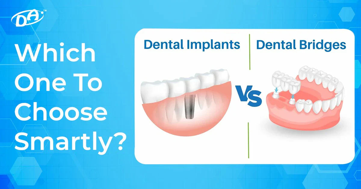 Dental Bridge vs Implant: Which One To Choose Smartly?