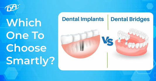 Dental Bridge vs Implant: Which One To Choose Smartly?
