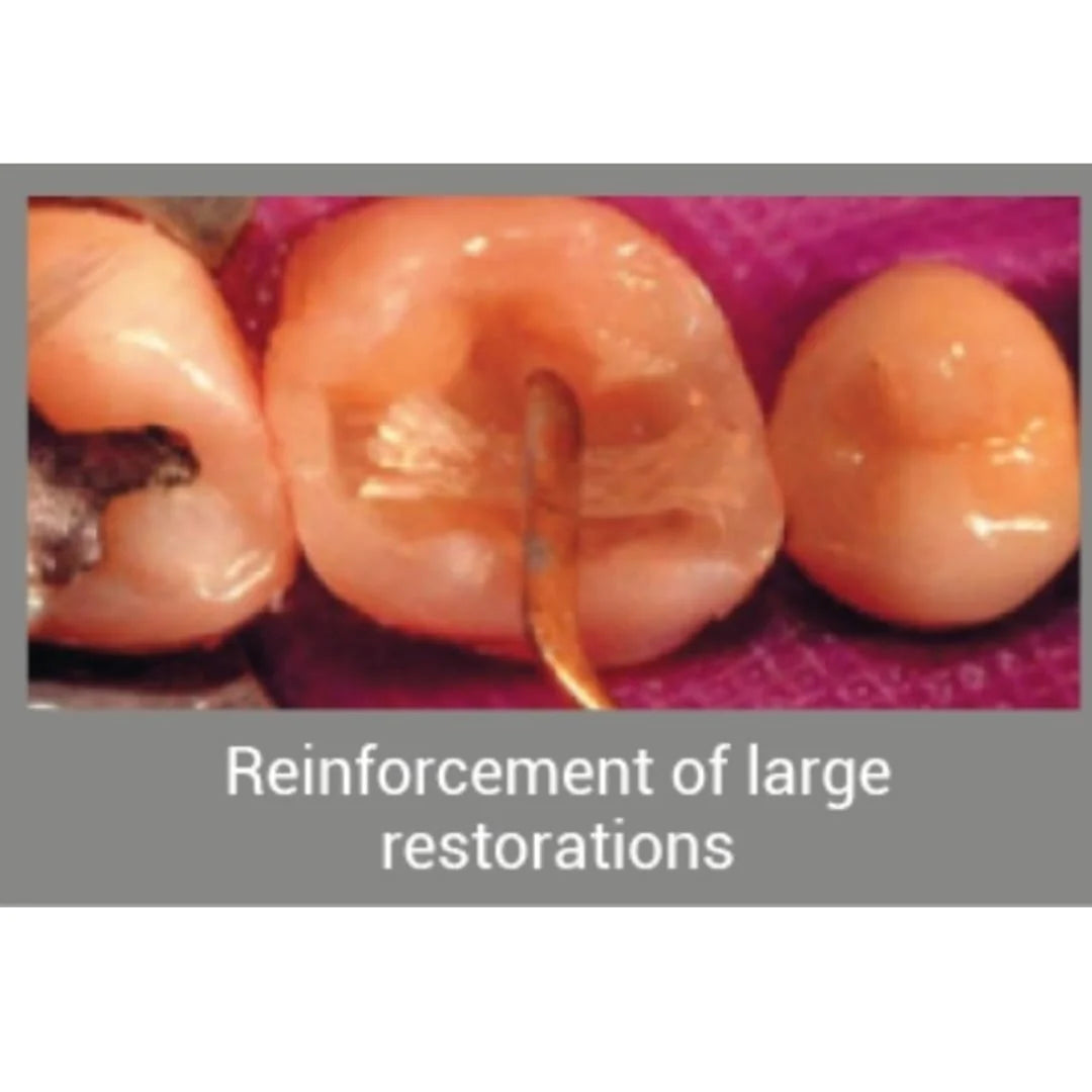 Angelus Interlig - Braided Glass Fiber impregnated with light-cured composite resin