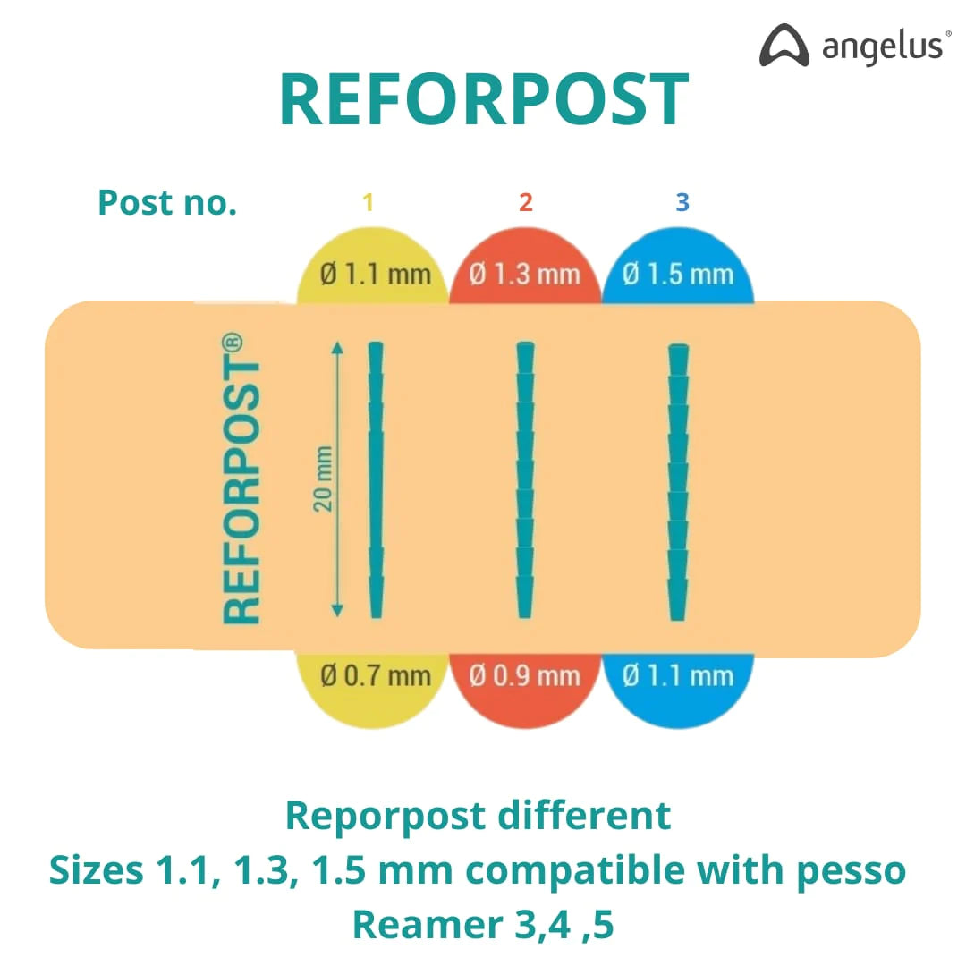 Angelus Reforpost Fiber Glass -  Intraradicular Post