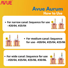 AVUE AvueAurum - Aurum (Gold) Heat Treated Rotary File System - Pack of 6