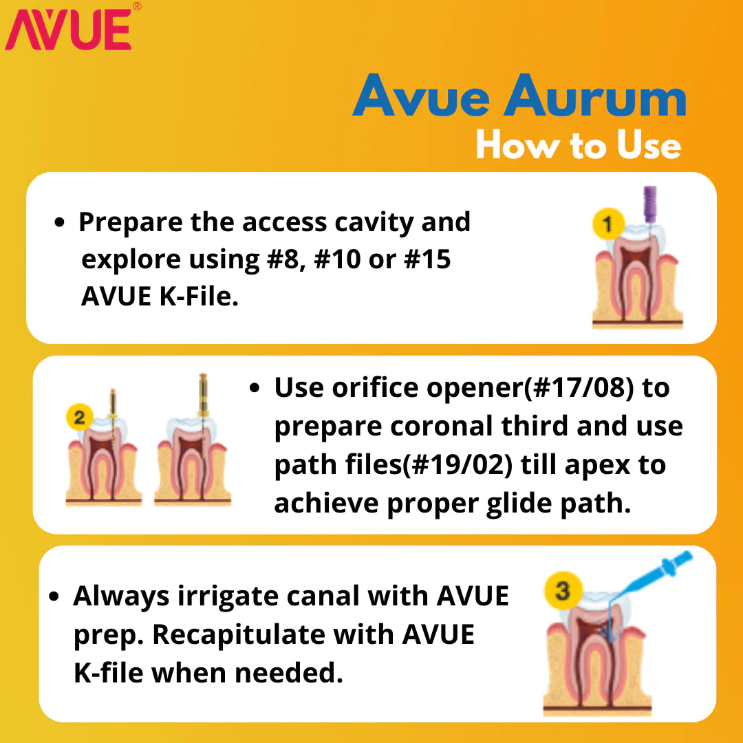 Avue Aurum - Gold Heat Treated Rotary File System - Pack of 6