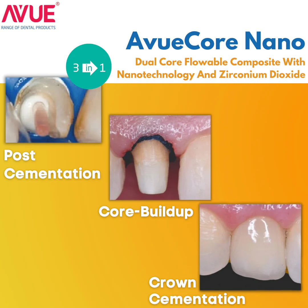 Avue Core Nano - Dual Cure Flowable Core Buildup composite with Nano Zirconium Dioxide