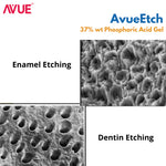 Avue Etch- 37% wt. Phosphoric Acid Gel