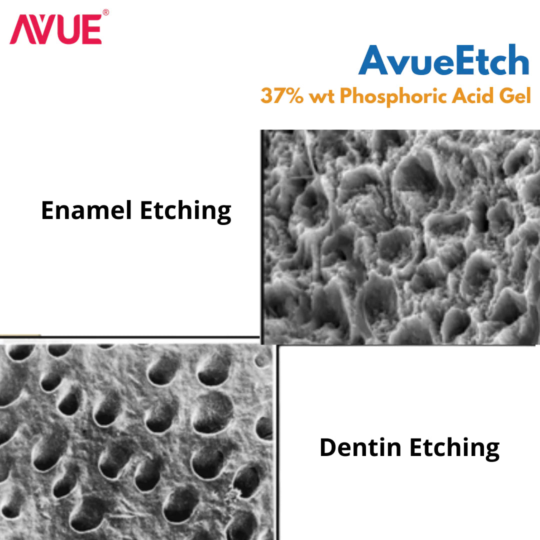 Avue Etch- 37% wt. Phosphoric Acid Gel