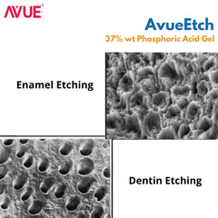 AVUE AvueEtch-  37% wt Phosphoric Acid Gel