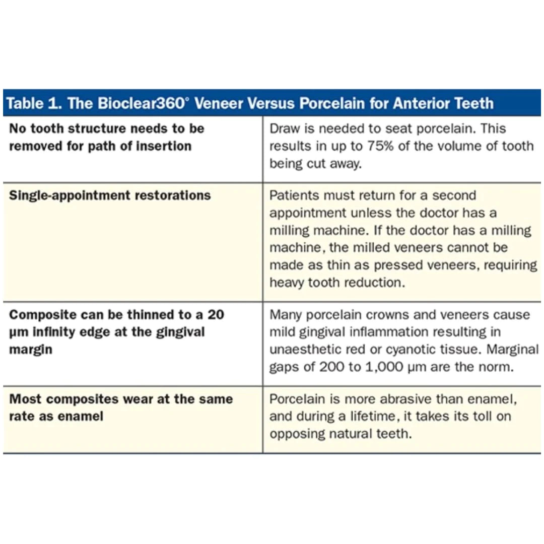 Bioclear 360°  Veneer Matrices - Significantly Stiffer Matrices for Composite Veneers