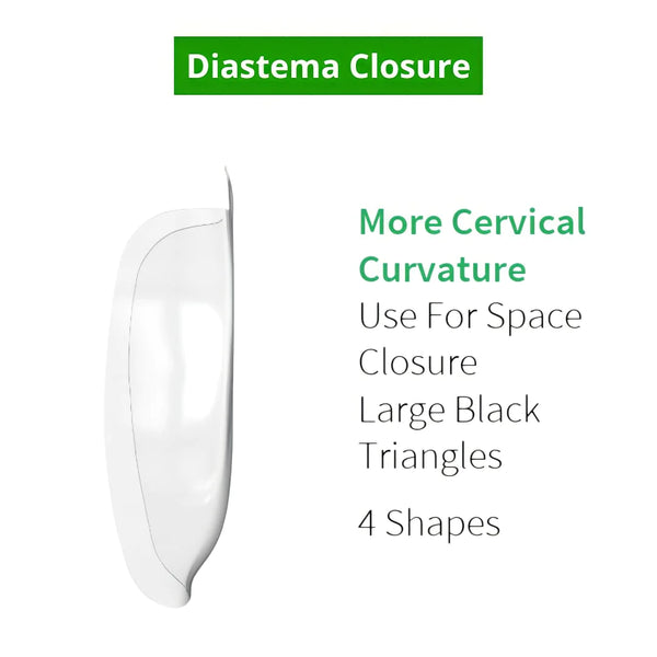 Bioclear Anterior Matrix – Diastema Closure Series by Dental Avenue