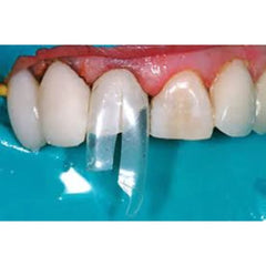 Bioclear 360°  Veneer Matrices - Significantly Stiffer Matrices for Composite Veneers