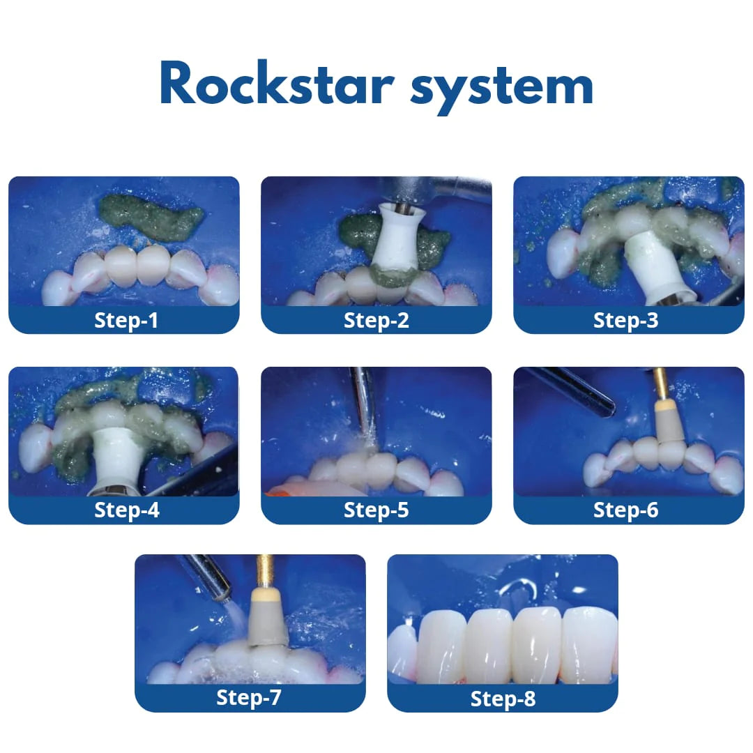 Bioclear Rockstar Polishing Kit -For Phenomenal Shine & Finish Of Composites