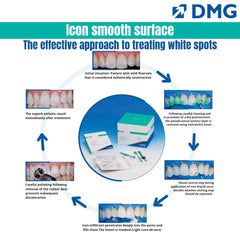 DMG Icon Smooth Surface - Caries Infiltrant