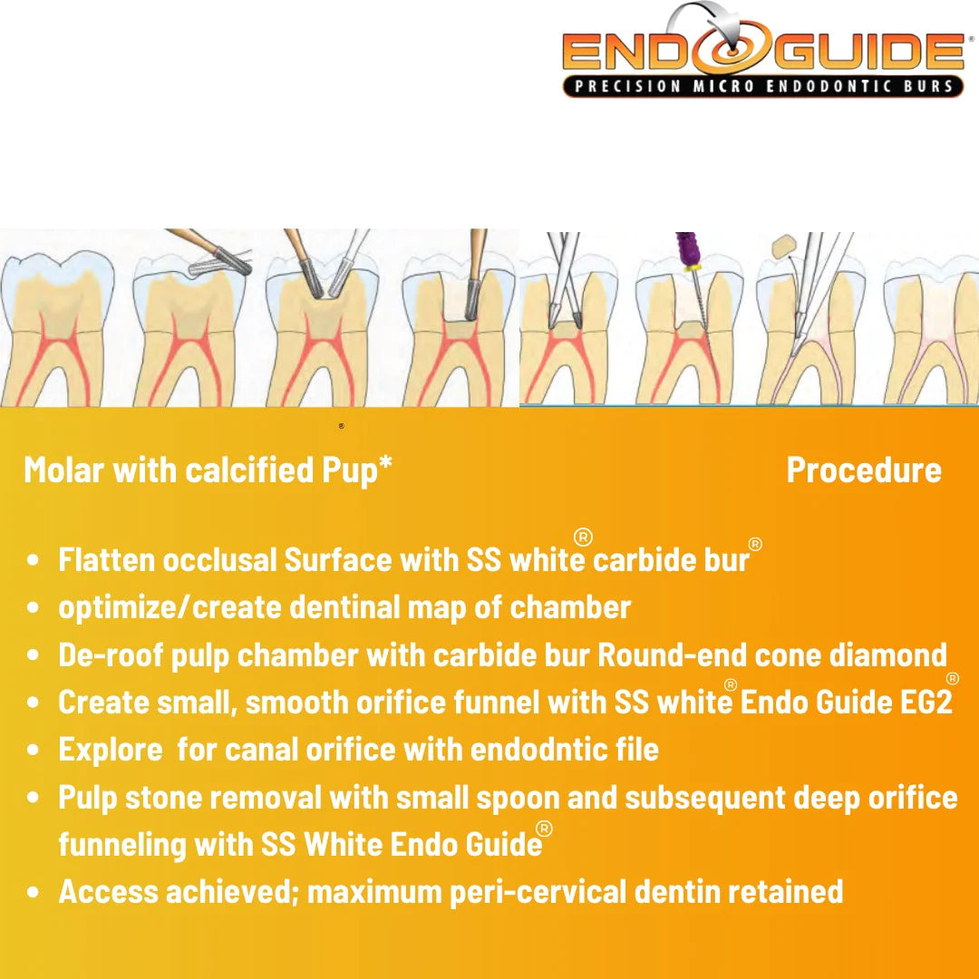 SS White EndoGuide - Precision Micro Endodontic Burs For Endodontic Access and Exploration