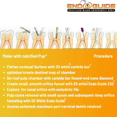 SS White EndoGuide - Precision Micro Endodontic Burs For Endodontic Access and Exploration