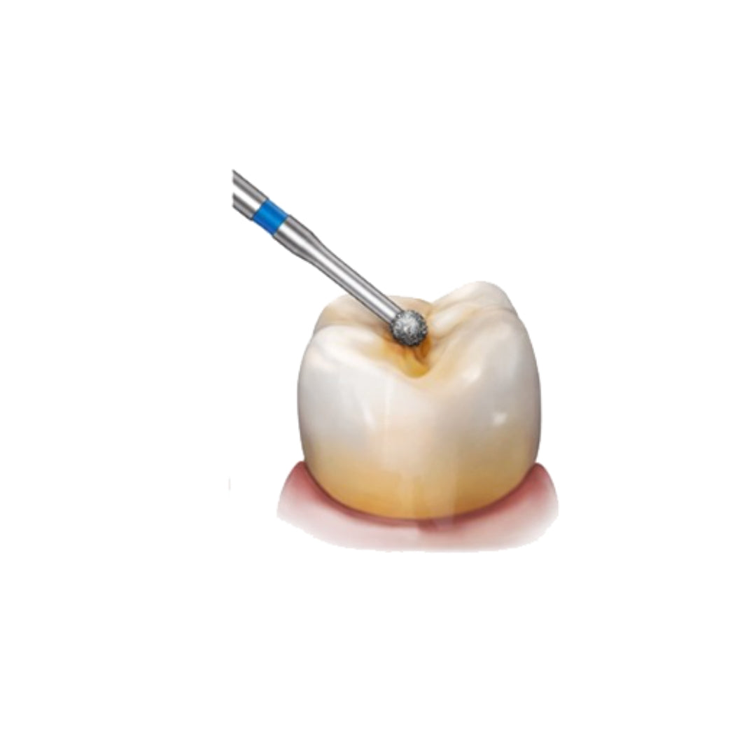 Avue True Diamond Burs- BR Series- Ball Round Shaped