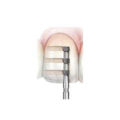 Avue True Diamond Burs- DC Series- Tri Wheel Depth Cutters