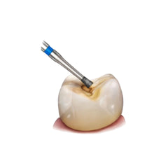 Avue True Diamond Burs- SI Series- Inverted Cone Burs